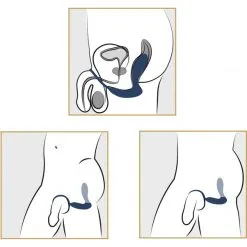 You2Toys Prostatastimulator Med Penisring -Onaniprodukter butikk 23326 you2toys vibrerende prostata stimulator med penisring 70 mood q100